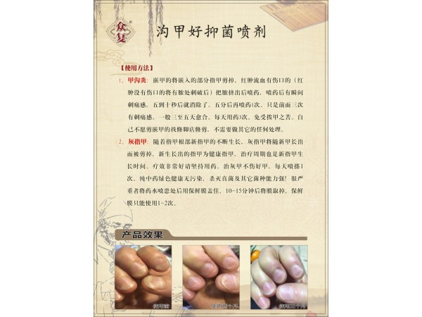 眾復溝甲好抑菌噴劑