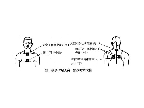 水凝膠型濟(jì)貝康清火貼