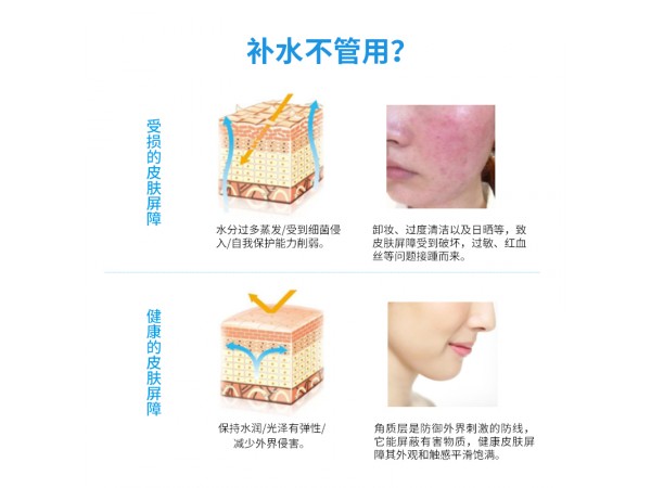 雅奇醫(yī)用冷敷貼