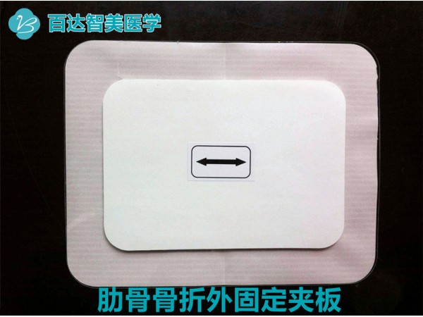 肋骨（胸骨）固定板（武漢百達(dá)智美醫(yī)學(xué)）產(chǎn)品優(yōu)勢和操作使用特點(diǎn)