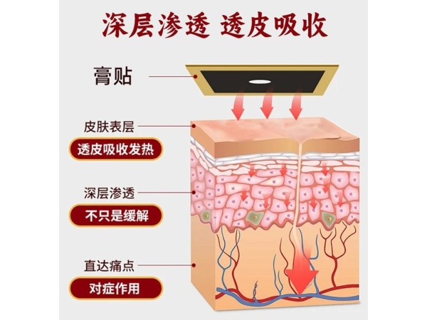 遠紅外磁療透骨貼腰肌勞損黑膏貼生產(chǎn)火烤膏貼廠家代理
