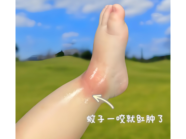 防蚊貼驅蚊貼片防蚊貼片兒童驅蚊貼廠家隨身驅蚊貼現(xiàn)貨戶外防蚊貼驅蚊貼劑驅蚊液
