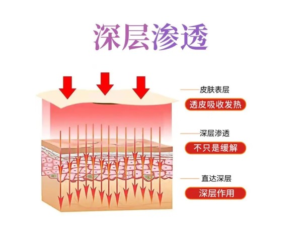 妊娠紋保健膏代加工  源頭廠家 規(guī)格定制 免費打樣 可oem貼牌